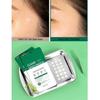 SOME BY MI Патчи Snail 30Days Miracle Clear Spot Patch, 18 шт. (10 мм, 9 шт. + 12 мм, 9 шт.), Гидроколлоидный тип