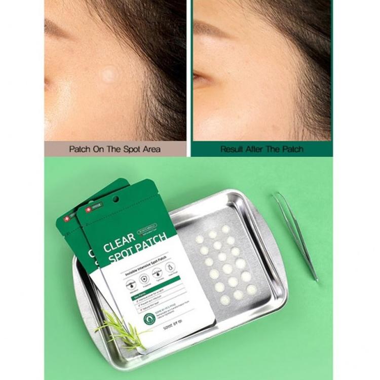 SOME BY MI Патчи Snail 30Days Miracle Clear Spot Patch, 18 шт. (10 мм, 9 шт. + 12 мм, 9 шт.), Гидроколлоидный тип