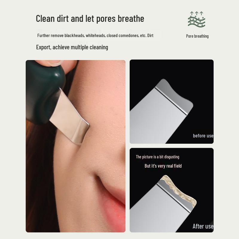 Mini Manual Pore Cleaner & Blackhead Remover Acne Peeling Machine for Home Beauty Use.