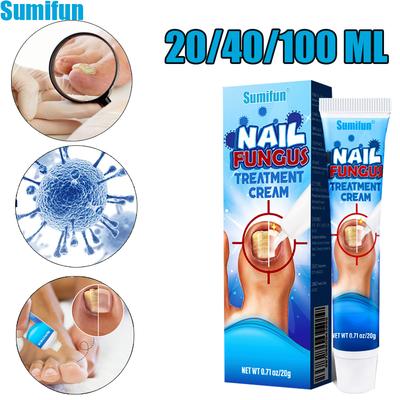 Sumifun 20/40/100 мл Крем для восстановления онихомикоза Убивает грибок ногтей Мазь Летний уход за ногтями ног Бактериостатическая мазь