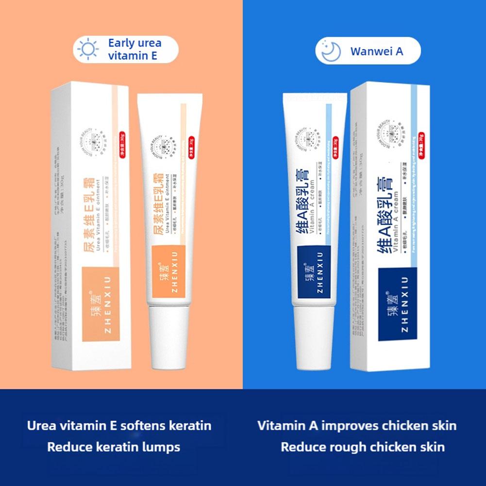 Крем для отбеливания тела Кератоз Фолликулярный Лечение Неровные Огрубевшие Ноги Курица Ремонт Уход Удаление F I0G2