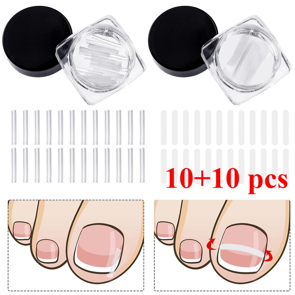 Корректор вросшего ногтя Полоски Ноготь Коррекция Ногтя Корректор Зажим Для Коррекции Выпрямление Ногтя Восстанавливающий Пластырь Корректор Изогнутого Ногтя 2 Стили