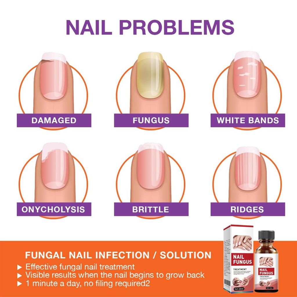 Powerful Nail Serum, Nail Care Fast & Advanced For Healthy Nails & Toenails, 20ml