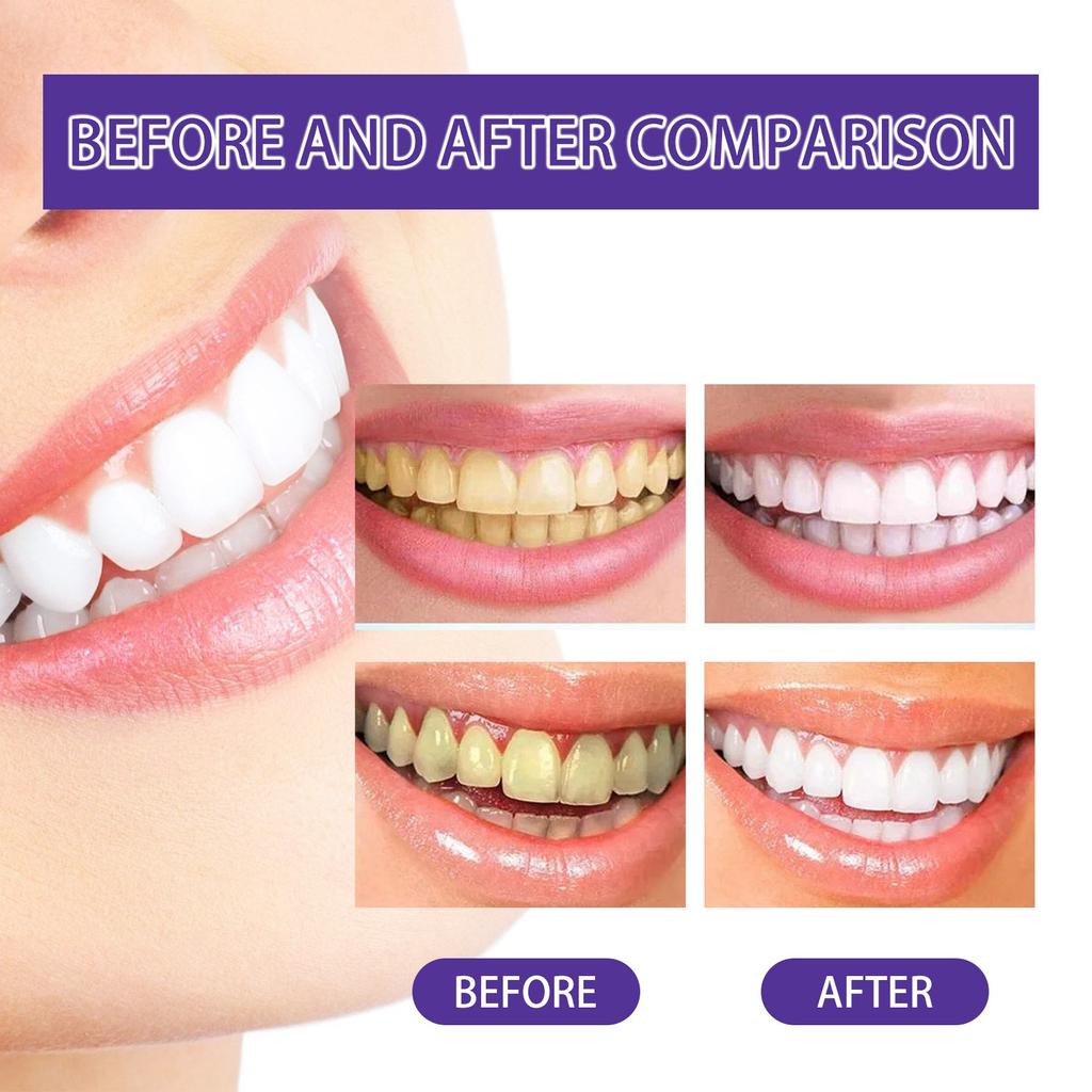 Toothpaste For Deep Cleaning, Teeth Care, Brightening, Warming, And Protecting Gums, Refreshing Breath, And Removing Odors 30ml