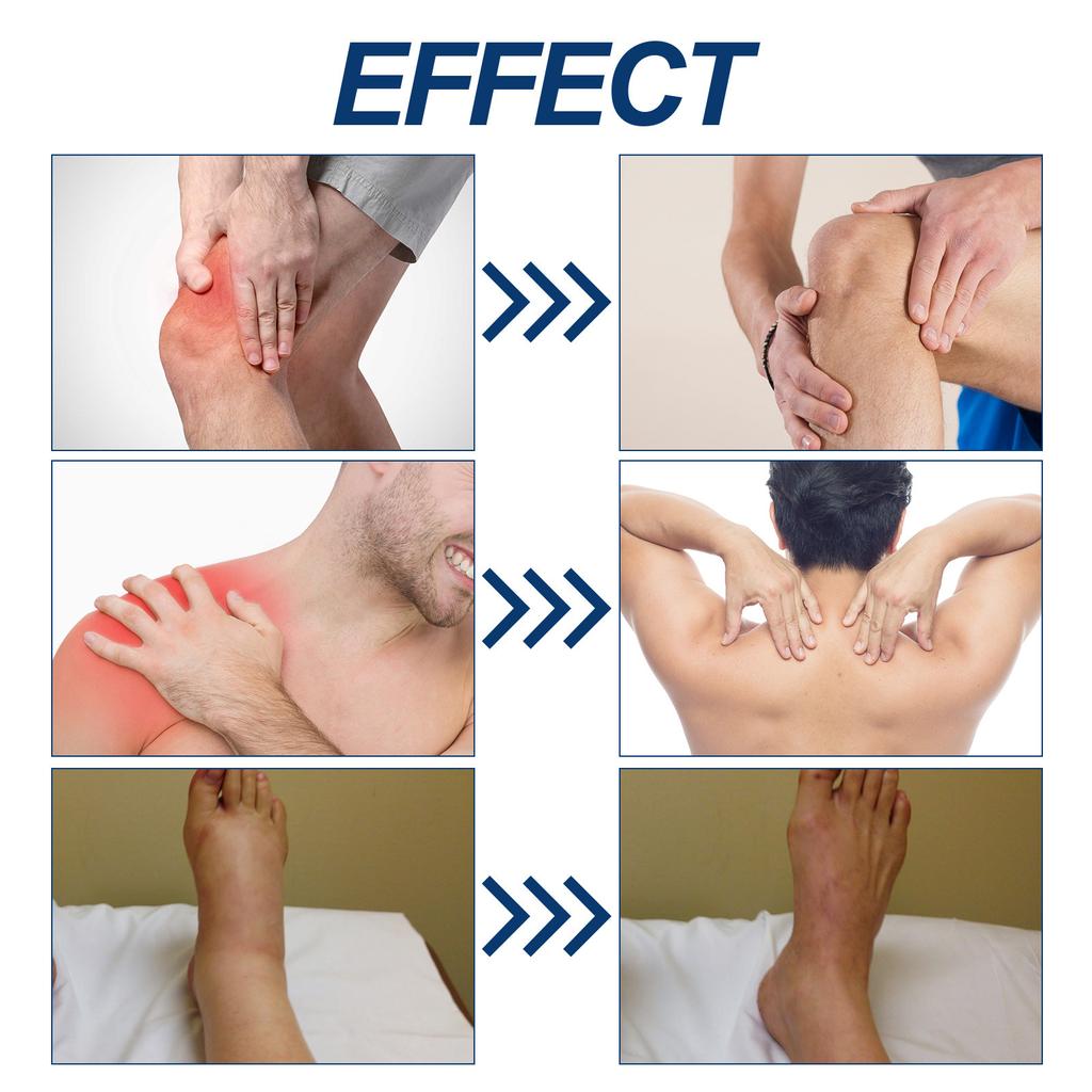 Крем для ухода за суставами Bee Joint Care Cream снимает боли в плечах, шее, поясничном отделе позвоночника, коленях, заботится о суставах и теле