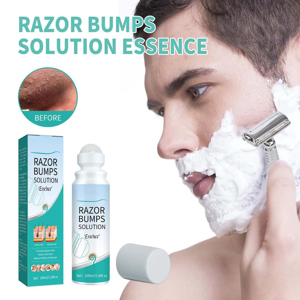 Средство для ухода за вросшими волосами Ball Bump Care для зоны бикини Jade Care, специально разработанное для деликатных зон, обеспечивающее целенаправленное облегчение от неровностей после бритья, 100 мл