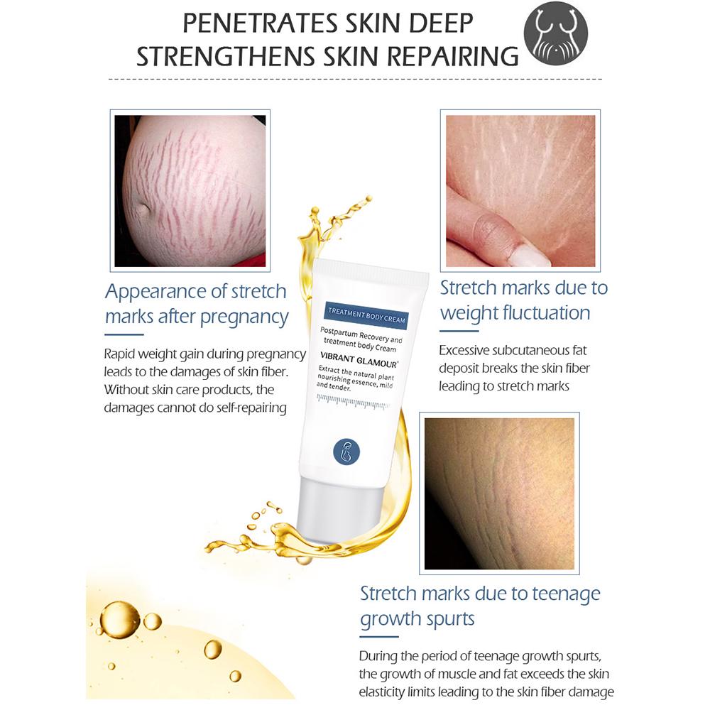 VIBRANT GLAMOUR Крем для удаления растяжек, набор кремов для ремонта тела, шрамы для беременных, линии ожирения, шрамы, антивозрастной укрепляющий уход за кожей, 2 шт.