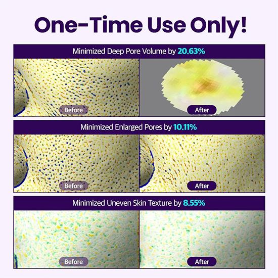 Dr.G Подушечки для спикул Bakuchiol Pore-Jet 30 шт.