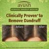 Шампунь для волос против перхоти с Нимом (175 мл), Anti Dandruff Neem Shampoo,  Lever Ayush
