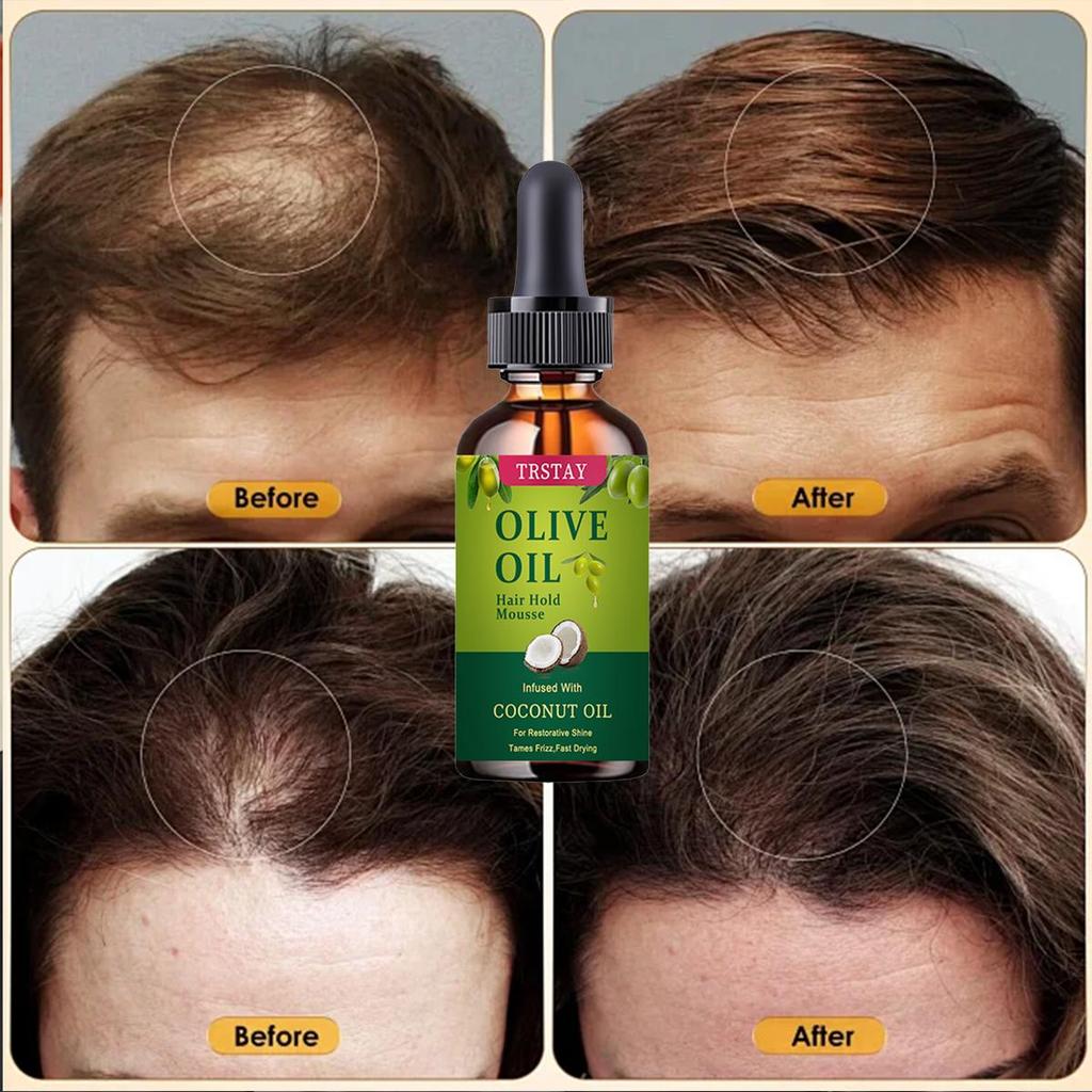 Biotin Fast Hair Growth Oil Hair Regrowth Serum Hair Thinning Treatment Hair Growth Liquid Anti-Hair Loss for Women & Men 10ML/20ML/30ML/50ML