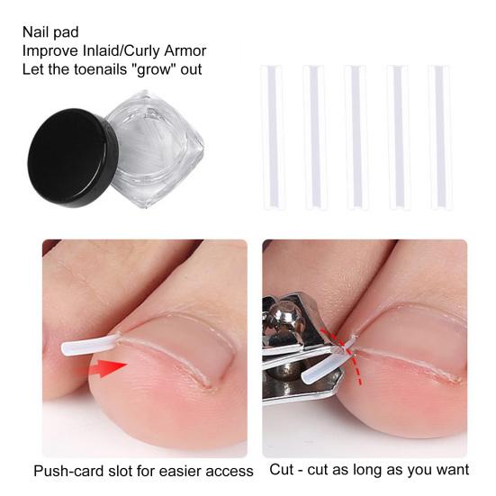 1 комплект, набор для коррекции ногтей на ногах, аксессуары для ухода без клея, премиум-корректор для маникюрного салона