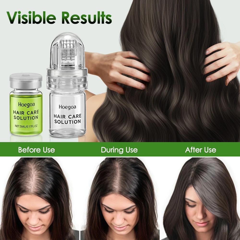 Hair Loss Prevention Serum Strengthen Roots Reduce Shedding Anti-Baldness Nourish Scalp Hair Care Conditioner Men Women 2oz