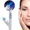 Синие прыщи, морщины, удаление пятен на коже, против варикозного расширения вен, ластик, лечение, портативное устройство для ухода за кожей