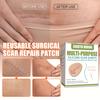Эффективная наклейка на шрам, умеренный самоклеящийся безопасный силиконовый лист для ремонта шрамов, здравоохранение