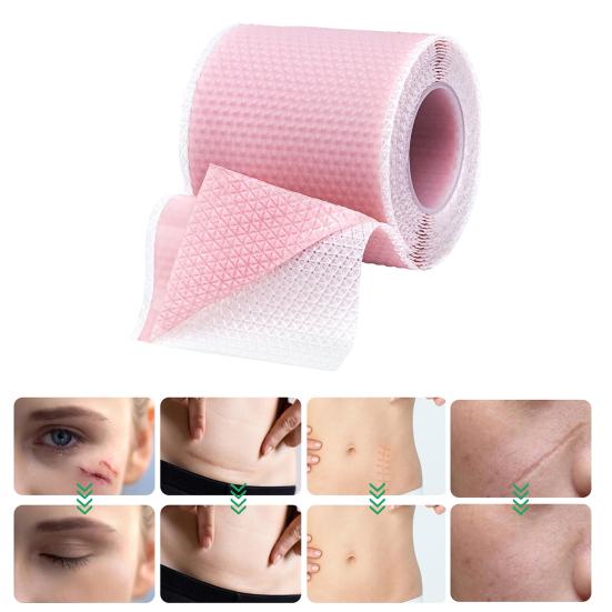 Силиконовые пластыри для рубцов, рулон ленты для рубцов, профессиональные мягкие полоски для рубцов после хирургических операций, келоидные рубцы, лечение угревой сыпи, силиконовый гелевый пластырь