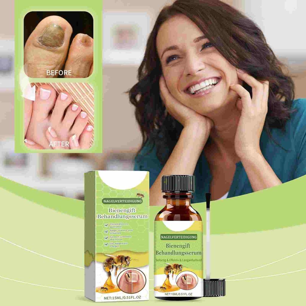 Сыворотка для ногтей, Сыворотка для ухода за ногтями Healthy Nails, Сыворотка для ухода за ногтями Honey Grapefruit Extract, Сыворотка для ухода за ногтями, Уход за ногтями от грибка, 15 мл/0,51 жидких унций