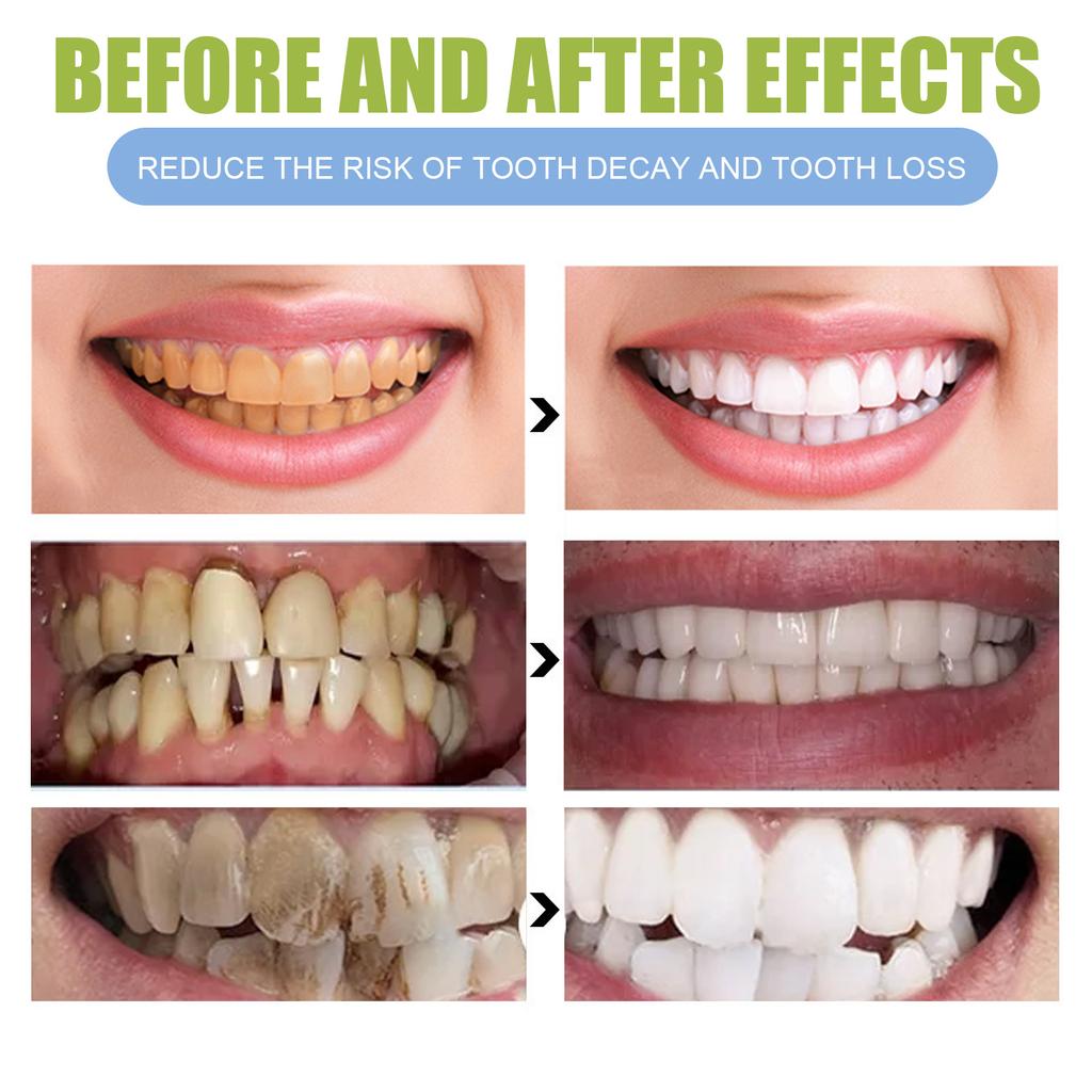 EELHOE Зубная паста для чистки зубов Гель для отбеливания зубов Глубокая чистящая пена Зубная паста удаляет пятна Свежее дыхание Инструменты для ухода за зубами 30 мл