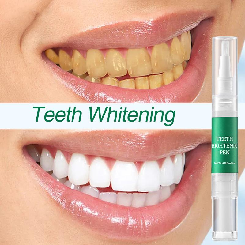 Ручка для отбеливания зубов, удаление пятен с зубов, удаление налета, черный цвет, отбеливание зубов, свежее дыхание, очистка рта, портативный уход за полостью рта