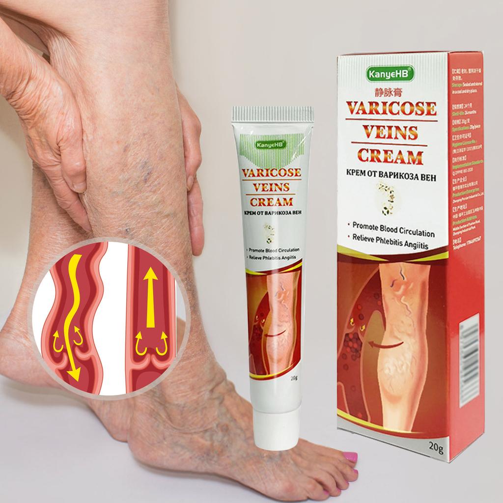 Varicose Veins Paste, Remove Varicose Veins, Varicose Veins Curing For Legs, Spider Veins Removal For Legs, Varicose Vein Renovate Paste