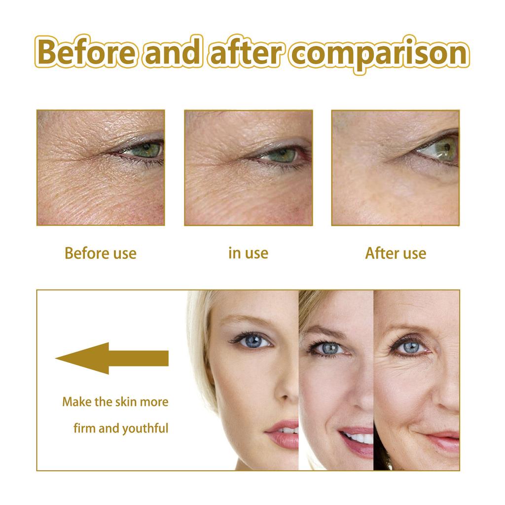 120 мл сыворотка для лица, антивозрастная эссенция женьшеня, никотинамид, лифтинг для лица, коллагеновая эссенция, уход за кожей, отбеливающая сыворотка