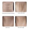 Neck Lifting Patch Invisible High Elastic Instant Neck Lift Bands for Double Chin Jowls Waterproof Neck Wrinkle Reducer