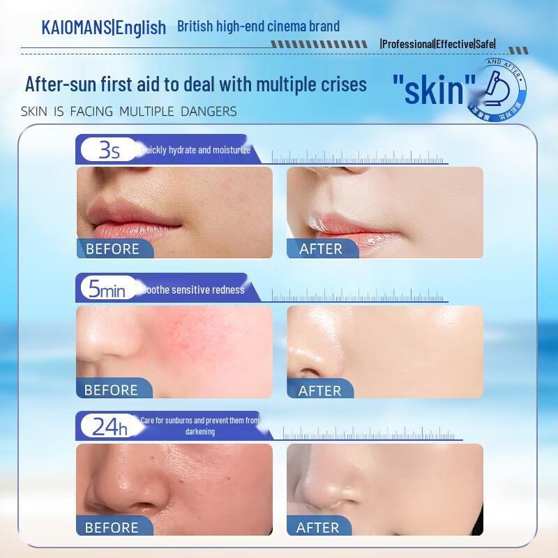 KALOMANS Успокаивающий крем после загара