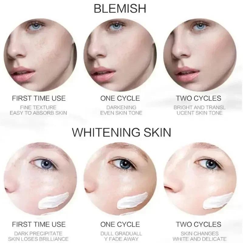 1/3/5pcs Whitening Freckle Cream Niacinamide Remove Dark Spot Cream Anti Freckle and Aging Cream Fade Pigmentation Melasma Skin