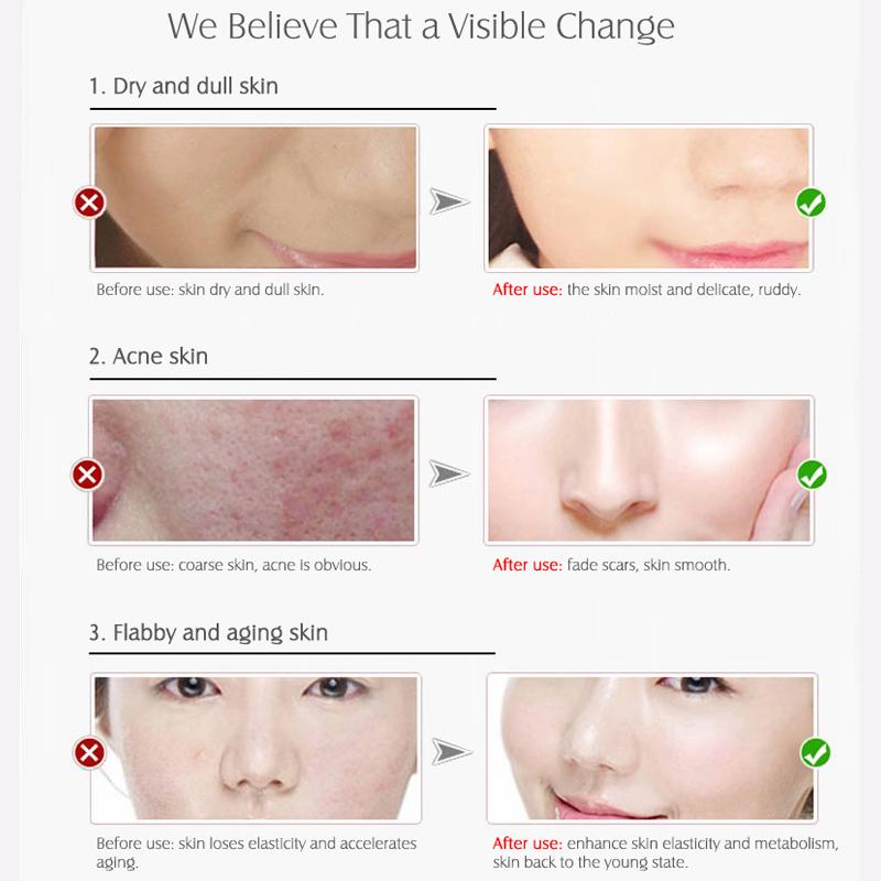 Сыворотка против старения и удаления веснушек ARTISCARE, отбеливающая и эссенция для лица против морщин, 3 шт./лот