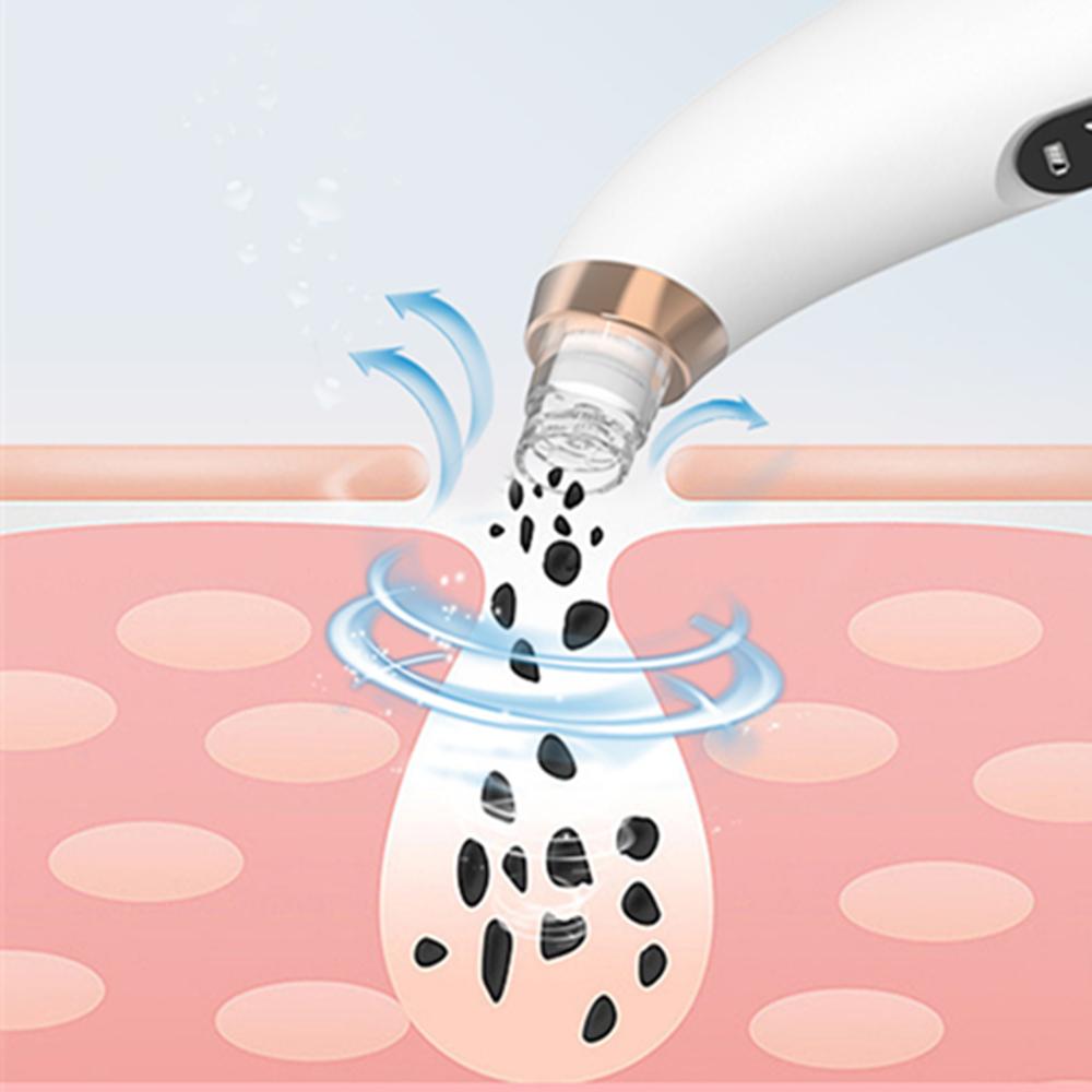 Blackhead Remover Facial Pore Cleaner Water Circulation Portable Vacuum Tool
