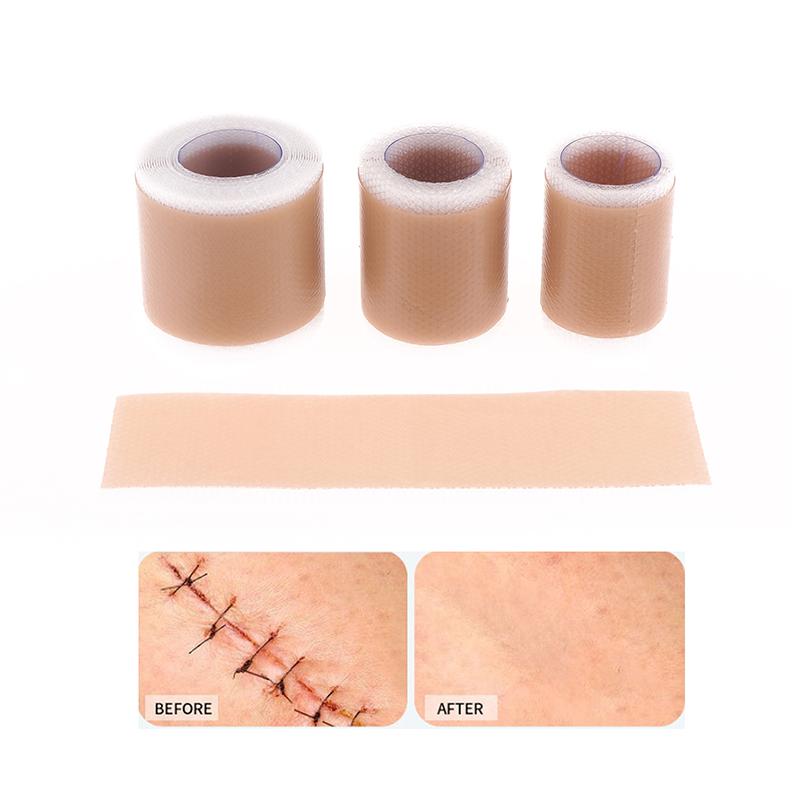 Силиконовый гель пластырь для лечения шрамов удаление пластыря покрытие ожог травма ремонт акне шрам от ушей раздел красота кожи