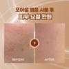 Athe Nmn Rapid Pore Ampoule 1pc Duo Set