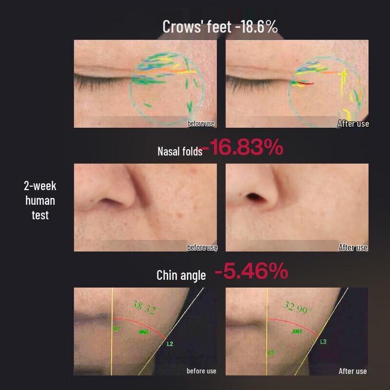 Косметологический прибор для лифтинга и подтяжки лица AMIRO R1 PRO