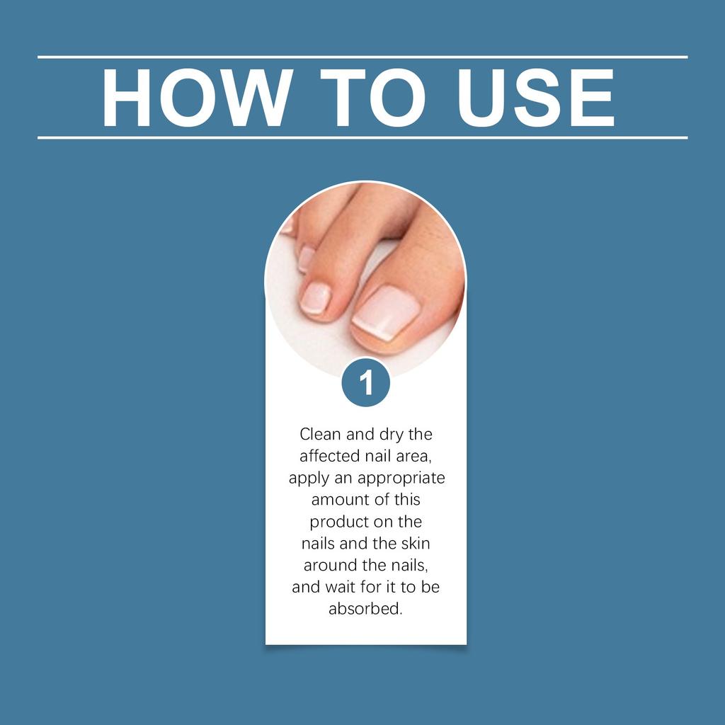 Мазь для ухода при онихомикозе, Крем для укрепления ногтей, Мазь для ногтей для укрепления ногтей и уменьшения расслаивания