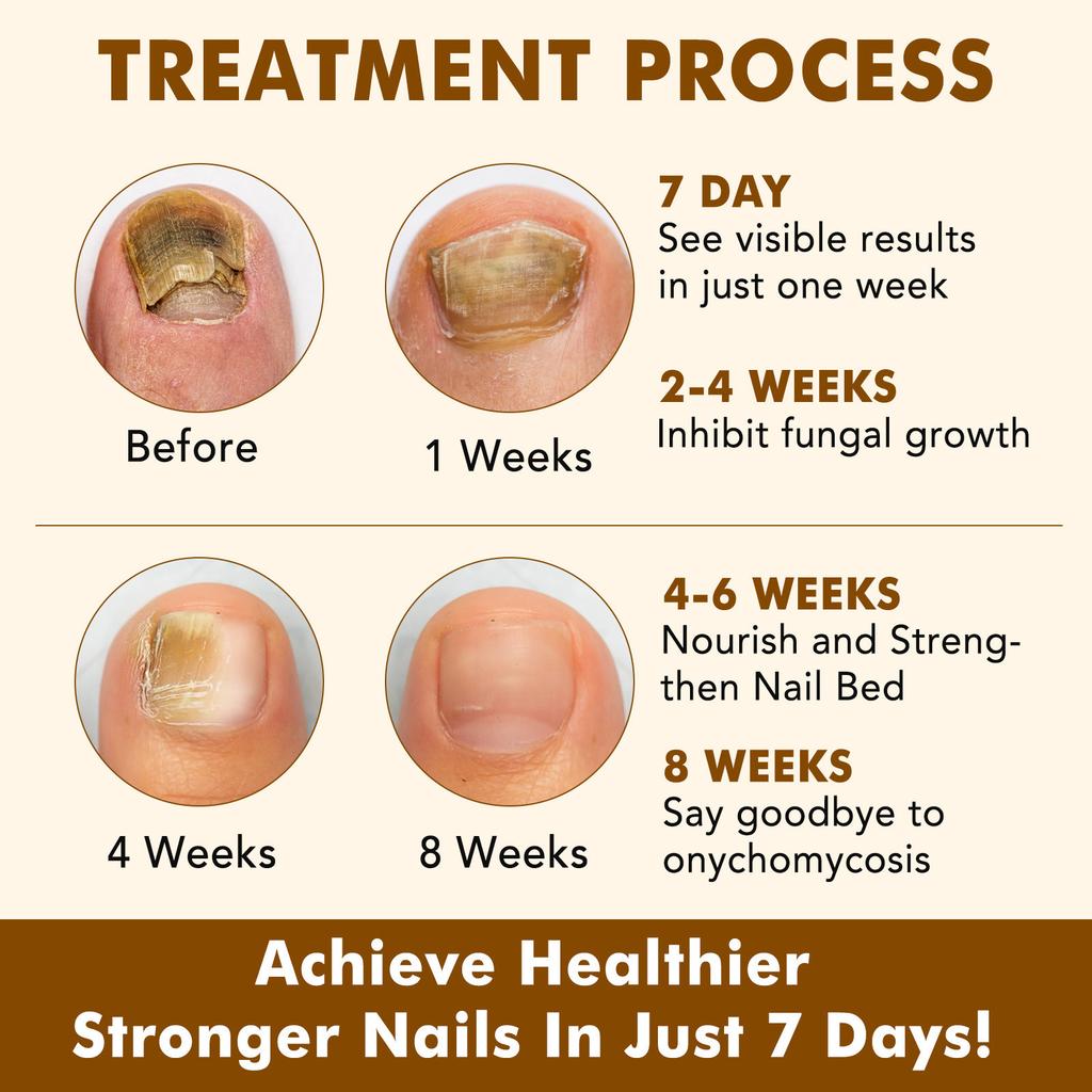Сыворотка для роста ногтей, осветляющая и укрепляющая питательная сыворотка для ногтей 60 мл