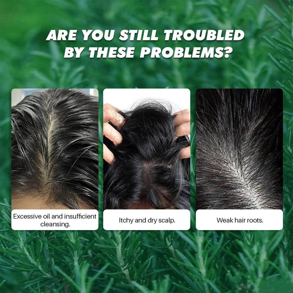 Scalp Scrub, Scalp Exfoliator, Scalp Exfoliating Scrub, Hair Care Nourishing Hair With Scalp Massager