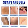 Крем от шрамов Пятна Разглаживание Укрепляющий Увлажняющий Осветление кожи Послеоперационный шрам Кожа Крем для заживления шрамов Уход за кожей