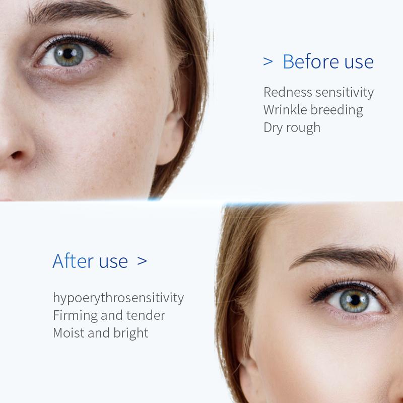 TJE Сыворотка с гиалуроновой кислотой 30 мл Увлажняющая, осветляющая, отбеливающая, омолаживающая, успокаивающая сухая сыворотка