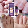 Toenail Fungus Care, быстродействующая жидкость для ухода за ногтями от грибка под и вокруг, восстанавливает здоровый вид ногтей 30 мл