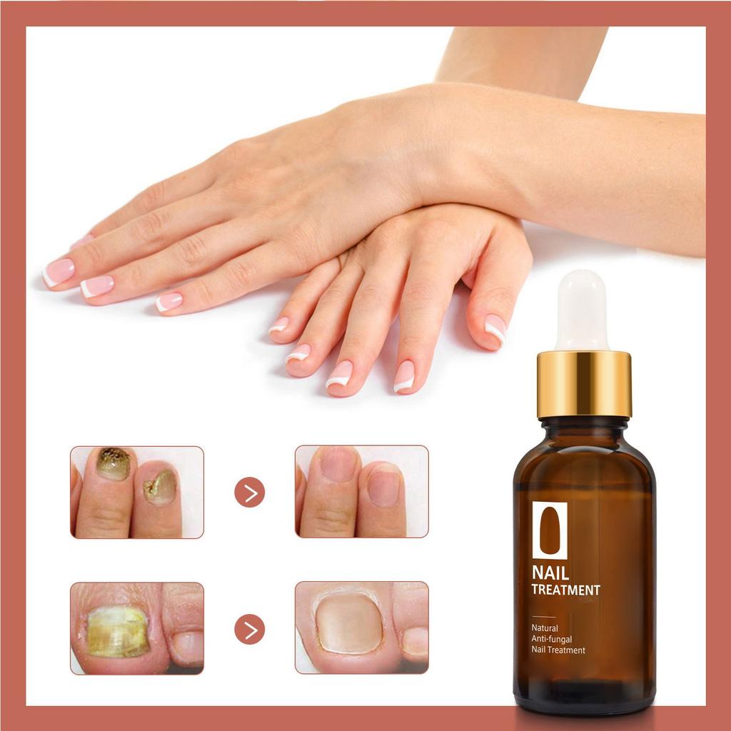 Крем-масло для ухода за ногтями, травяное растение, крем-масло для ухода за ногтями серого цвета для рук и ног, 30 мл