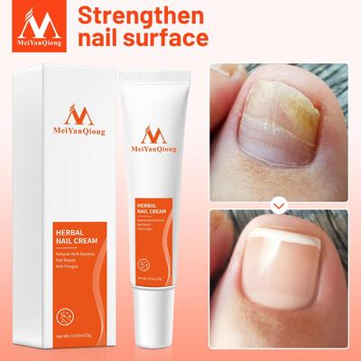 Средства для наружного применения – Удалено Противогрибковые кремы и масла