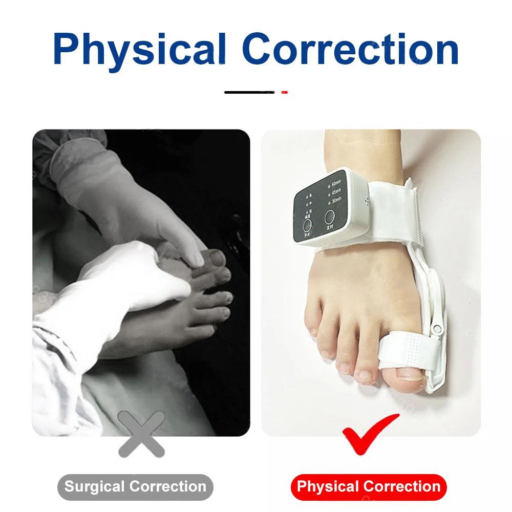 Вибрационный массажер Корректор косточки большого пальца стопы Унисекс Стопа Вальгусные скобы Разделитель пальцев ног Корректор пальцев ног Выпрямитель Регулируемый