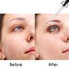 Eye Serum For Styes Chalazion And Blepharitis, Cleanses Lashes And Eyes,Healthier Eye Skin 20ml