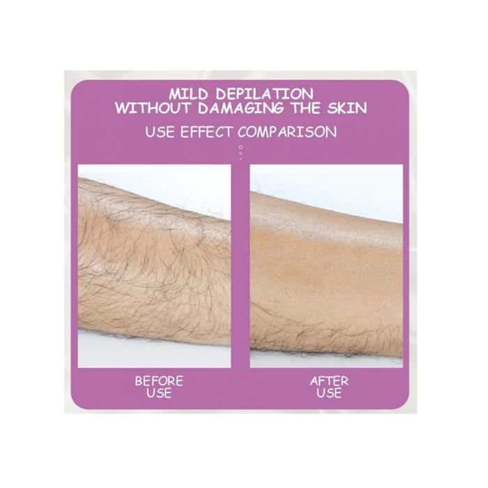 Эпилятор - Crystal Hair Eraser - Физический эпилятор - Безболезненный - Портативный - 10 штук