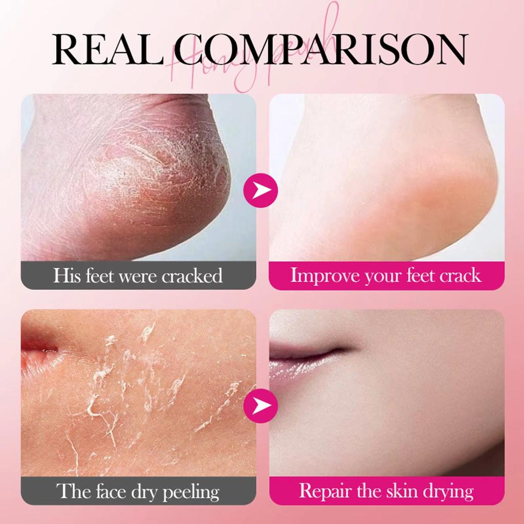 Ультраувлажняющий крем для ног для сухих потрескавшихся пяток - 40 г - Обогащен витамином Е и гицерином, не содержит спирта, фито-сквалана - смягчает и питает кожу