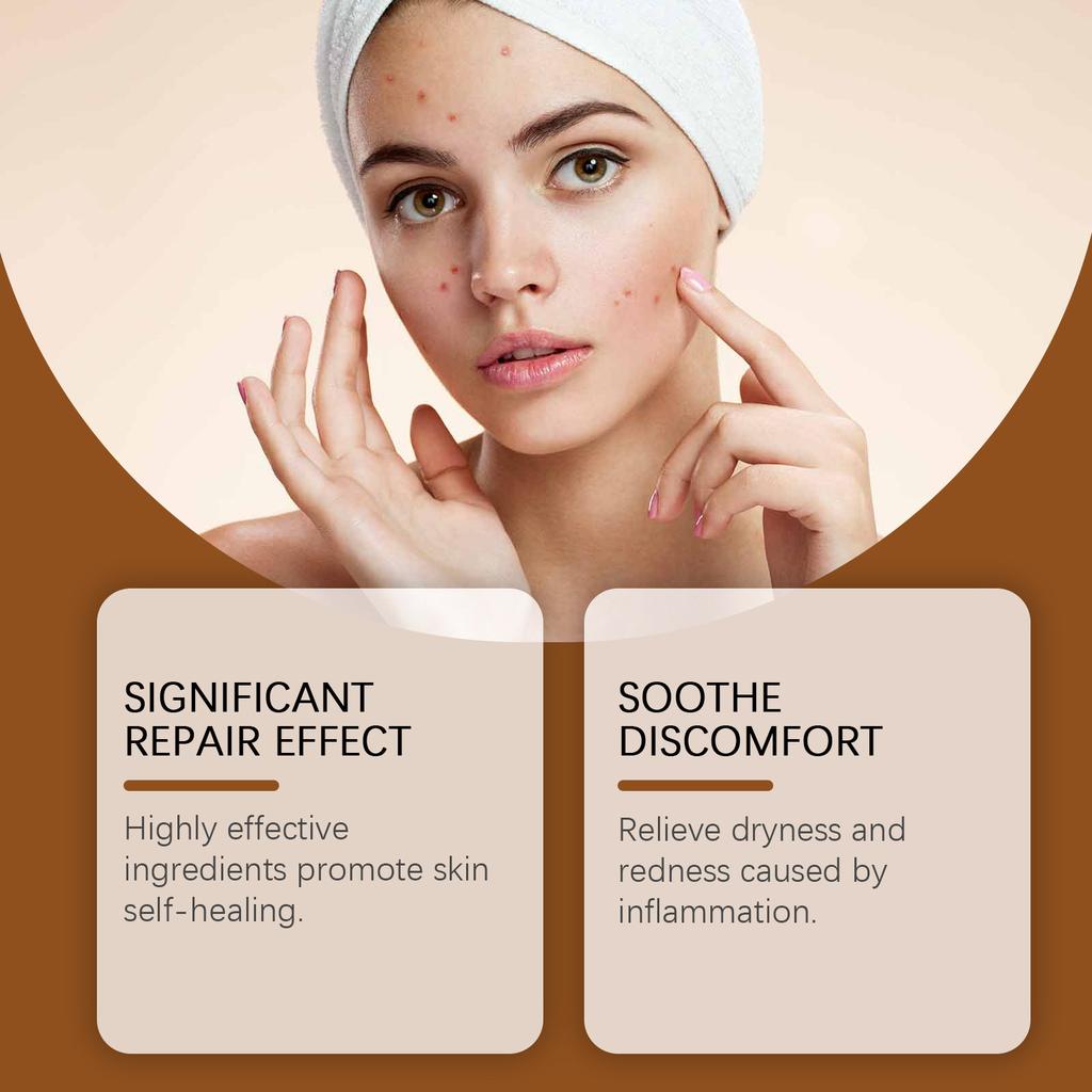 Универсальный крем для ухода за кожей, успокаивающий крем для кожи, устраняет папилломы и родинки; Устраняет сухость, чувствительность, вызванную экземой, 1 шт, 50 г