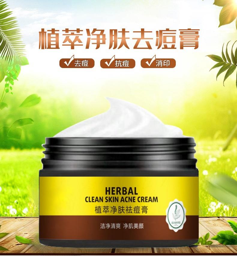 Acne Removing and Acne Removing Acne Repair and Desalination of Acne Print Cream