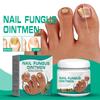 Gray Nail Paste, Thickened Shiny Nail, Gray Nail Repairs, Clean And Soft Nail Paste, Care For Hand, Foot And Toenail Decay