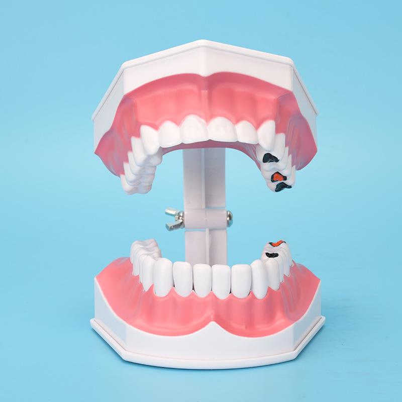 Детская модель зубов для обучения чистке зубов – съемные нижние зубы, размер 2x для обучения в детском саду