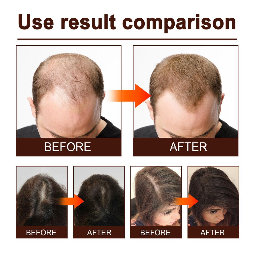 Eelhoe Сыворотка с ферментированной рисовой водой, натуральная нежная рисовая вода, эссенция для волос с ферментированной рисовой водой, сыворотка для роста волос для истонченных волос, 60 мл