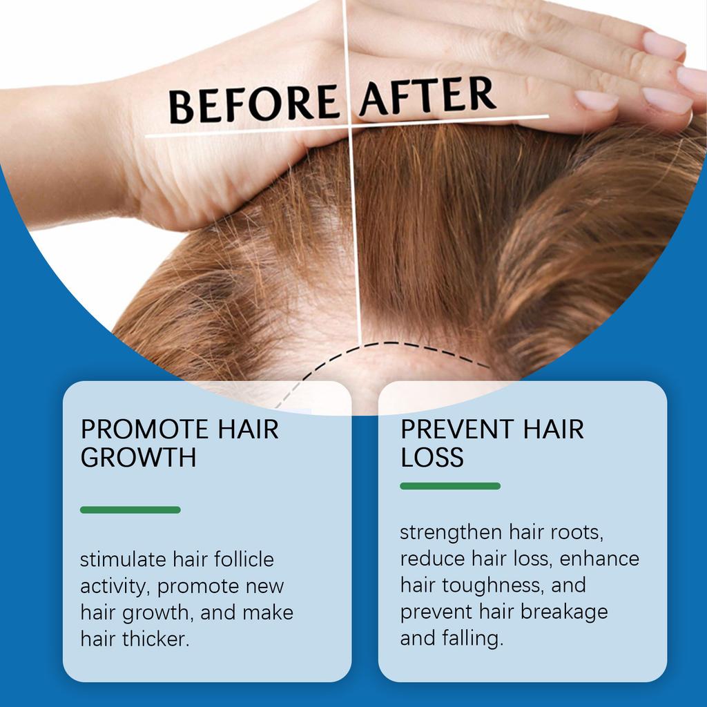 Жидкость для стимулирования роста волос активизирует волосяные фолликулы, уменьшает выпадение и ломкость волос, делает волосы черными и блестящими.10 мл